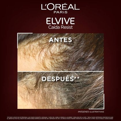 Resultados del acondicionador Aminexil Colombia. Antes y Después: Cabello más denso y cuero cabelludo menos visible